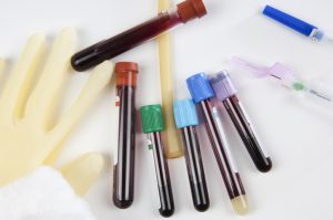 Rising Blood Alcohol Content as a DWI Defense